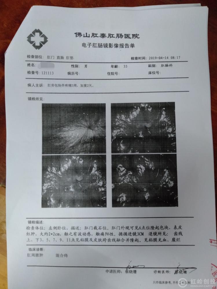 父亲胰腺癌,本人肛周脓肿手术